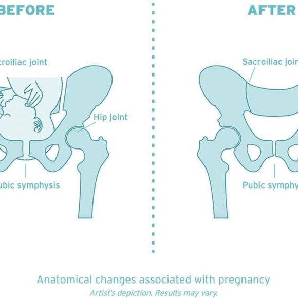 🅢🅐🅛🅔 HipSlimmer - Postpartum Compression Adjustable Pelvis SIZE:Small NEW!! - Picture 5 of 13